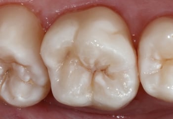 8292-Campus-Composite-Posterior-Thumbnail-D1