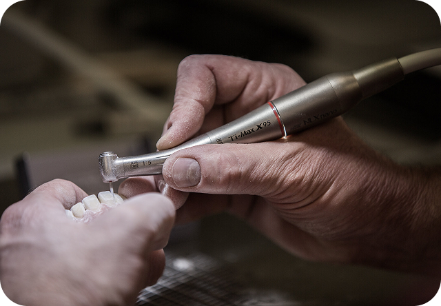 Excellence in Composite Restorations-2