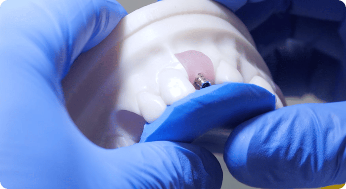 Implants-Workshop-Hero