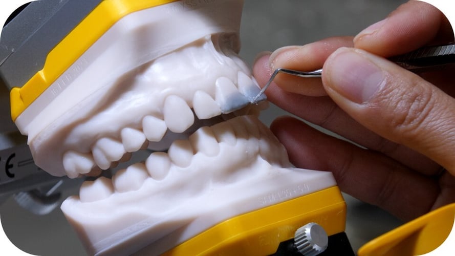 worn-dentition-1