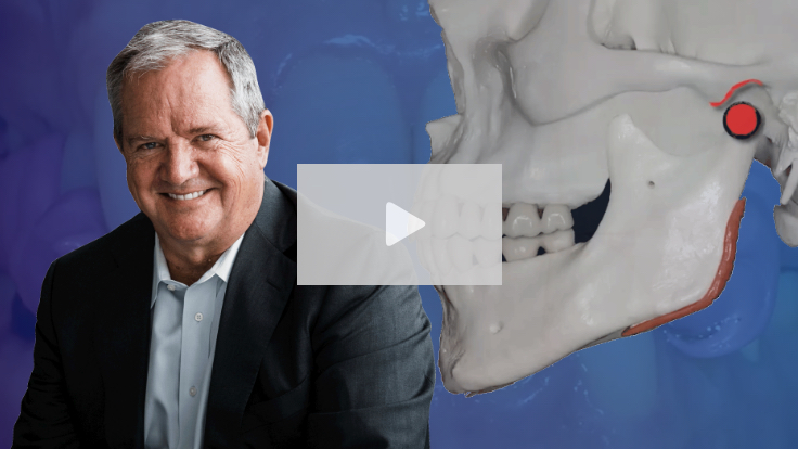 Demystifying Occlusion