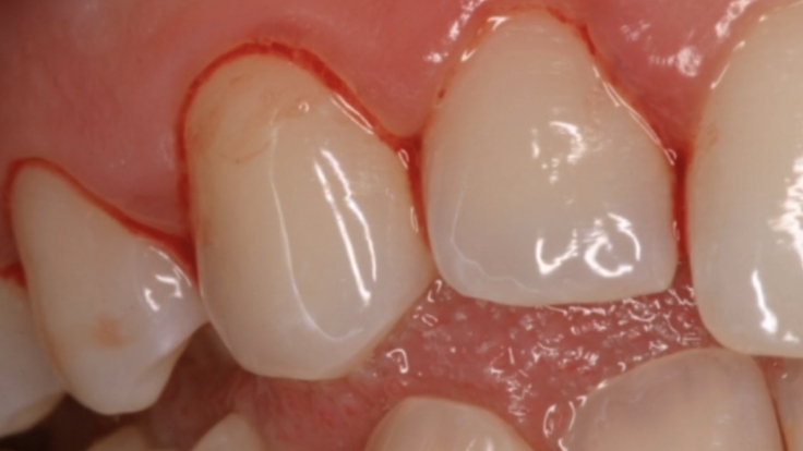 Hygiene-Series-LP-2