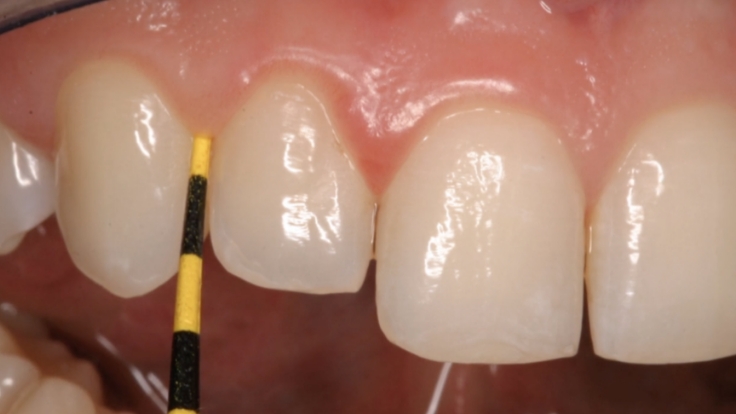 Hygiene-Series-LP-3