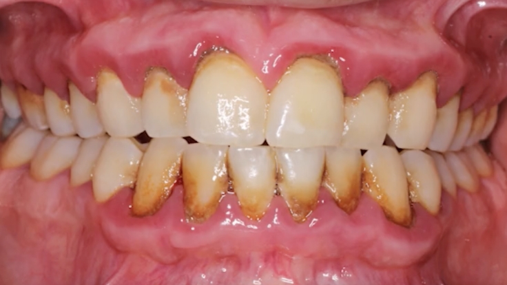Hygiene-Series-LP-4