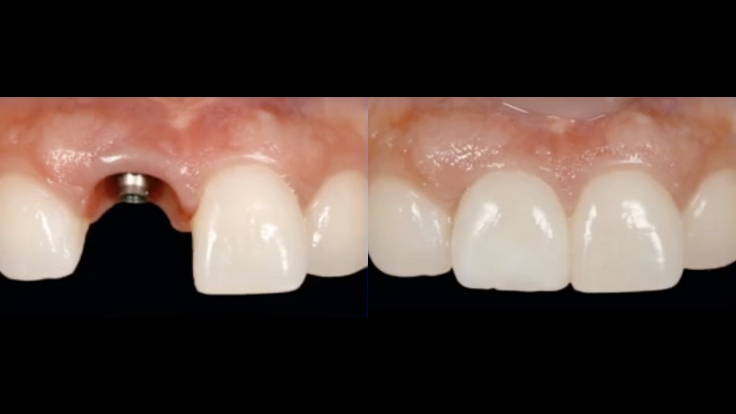 Hygiene-Series-LP-5