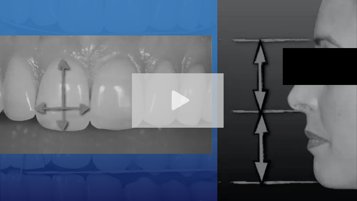 Unlocking Your Practice’s Potential Through the 'Facially Generated Treatment Planning' System