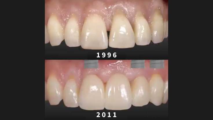 The Integration of Minimally Invasive Concepts into Complex Treatment Plans