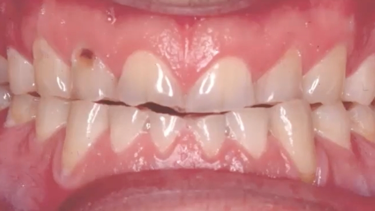 Faculty Club Roundtable - It’s Time to Rethink TMD