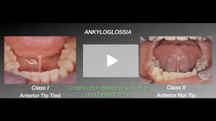 Dentistry’s Role in Identifying and Treating Children’s Airway Issues