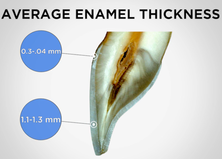 enamel thickness, opens in new window